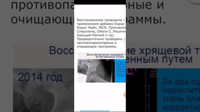 Как работает питьевая гиалуронка с хондроитином 🤩 смотреть онлайн