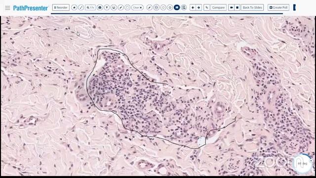 # PATHBOARDS High Yield Dermatopathology for Boards смотреть онлайн
