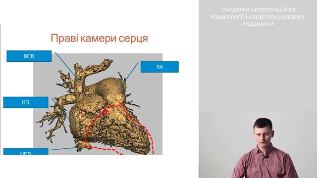 Можливості 3D-аналізу анатомії серця. Ч.1 смотреть онлайн