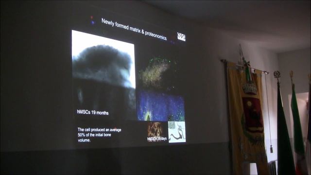 Elisa Budyn : "Long-term study of stem cell derived osteocytes in bone-on-chip" смотреть онлайн