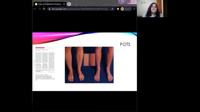 Baroreceptor's Role In The Cardiovagal Control In POTS Patients смотреть онлайн