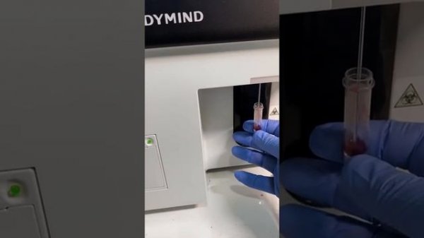 Обзор анализатора Dymind DH 36