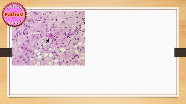 A to Z of Pathology: Letter "A" смотреть онлайн