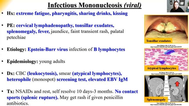 Infectious Disease Review PODs Part 1 PA NP Didactic PANCE PANRE смотреть онлайн