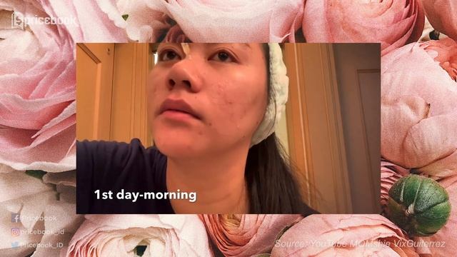 100 RIBUAN! Wajah Glowing Pakai Serum Korea Terbaik! смотреть онлайн