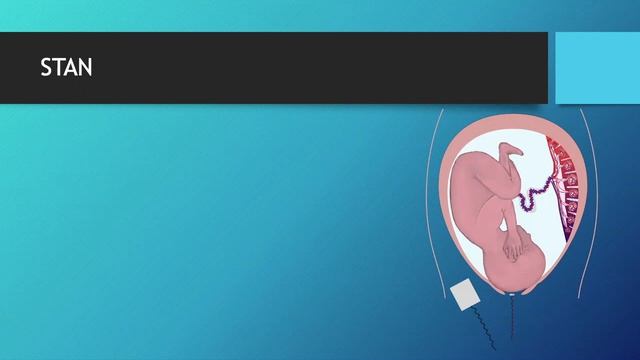 CTG Teaching 11 08 20 Part 1 (Adjunctive Techniques for Assessment of Fetal Well-Being) смотреть онлайн