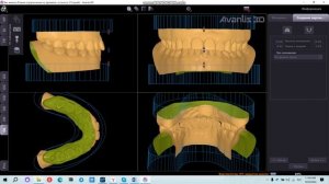 Вертикулятор