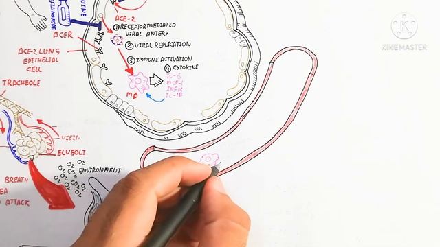Covid19,Pathophysiology,Crona Virus Infection,Sars And Mers смотреть онлайн