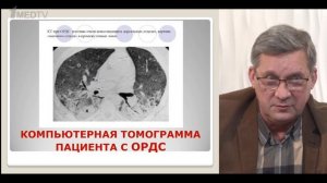 Острый респираторный дистресс-синдром. Андрей Малявин