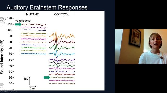 Gene Therapy for Usher Syndrome Type 1C, Gwenaëlle Géléoc, PhD смотреть онлайн