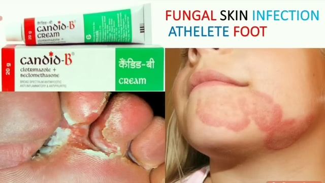 सभी creams/ointments एक ही वीडियो मैं/कौन सी cream किस काम आती है/किस cream का use कब करते हैं/क्री смотреть онлайн