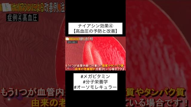 【高血圧の予防と改善！】ナイアシンのサプリ効果！！ смотреть онлайн