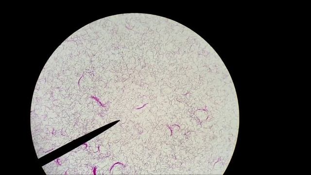 Spiral bacteria смотреть онлайн