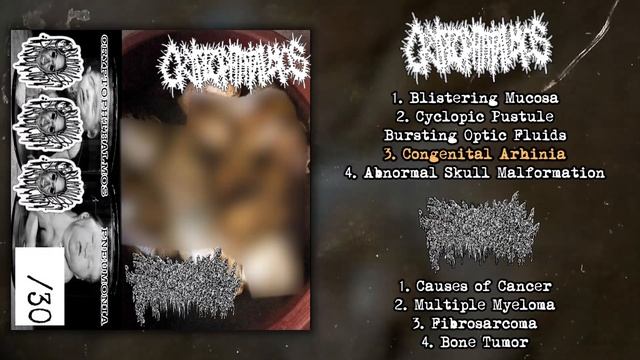 Cryptophthalmos / Pneumonia - split MC FULL ALBUM (2021 - Goregrind / Mincecore) смотреть онлайн