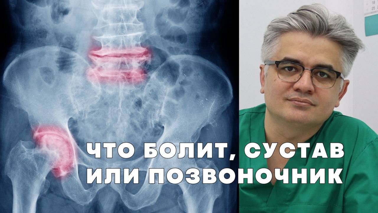 Что нужно проверить перед заменой тазобедренного сустава | HIP-Spyne syndrome смотреть онлайн