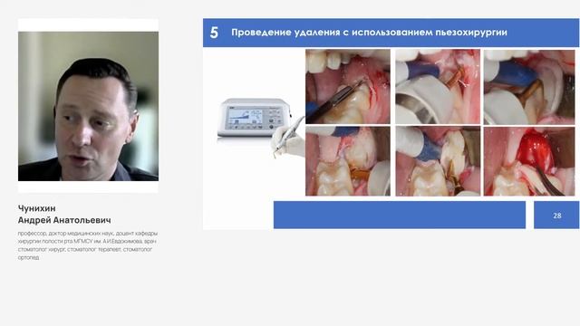 Методики атравматического удаления зуба