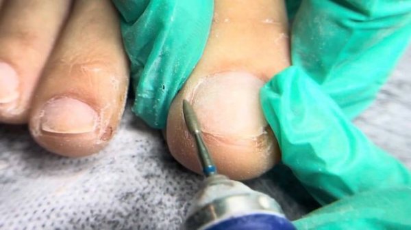 Преображение педикюра