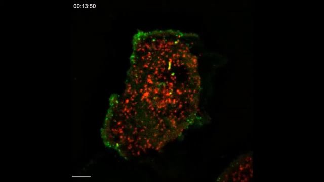 Science Signaling : Synaptojanin 2 Is A Druggable Mediator Of Metastasis And The Gene...