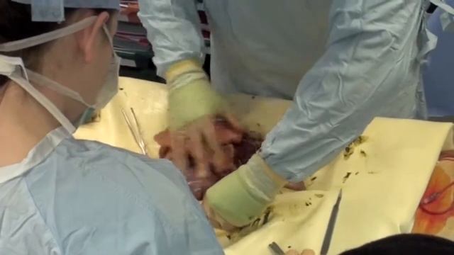 Amin 4 the operation part2 смотреть онлайн