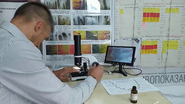 капилляроскоп в Нуга Бес!! смотреть онлайн