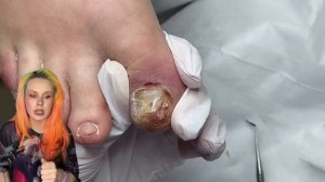 ЭТОТ СЛУЧАЙ МЕНЯ НАПУГАЛ #аленалаврентьева #подолог #подология #обучениеподологии #толстыйноготь