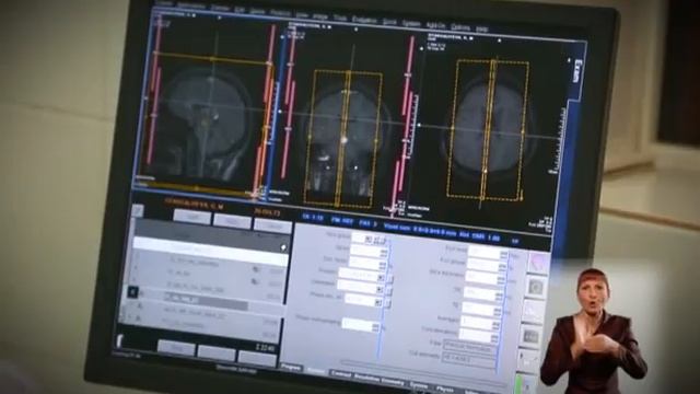 4 Болезни системы кровообращения Рус смотреть онлайн