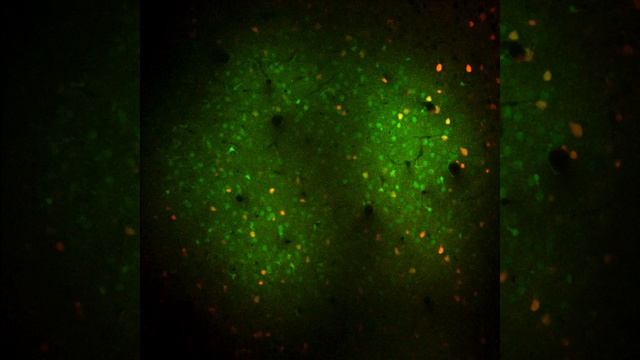 Smirnakis lab - OGB labelled neurons смотреть онлайн