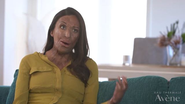 Turia Pitt - Avene Sunsitive Campaign смотреть онлайн