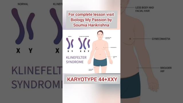 Klinefelter's Syndrome #shortsfeed #genetics #biology