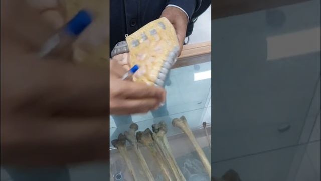 آناتومی عملی گوارش برروی مولاژ (روده کوچک؛ روده بزرگ)