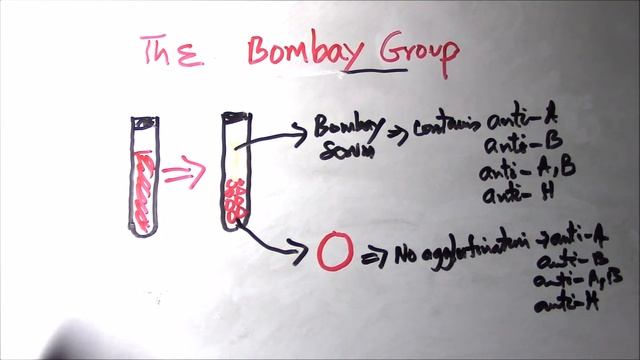 ASCP Exam Review Bombay Phenotype смотреть онлайн