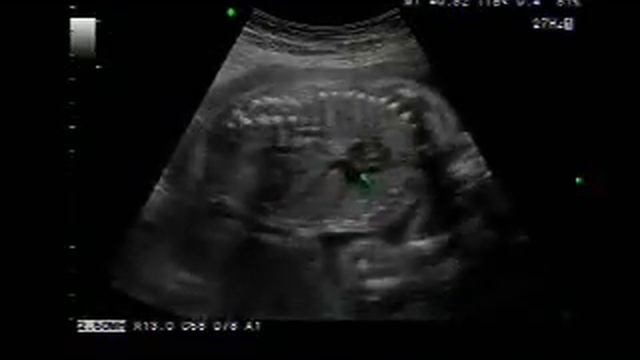 УЗИ 22 декабря