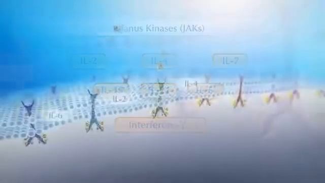 Rheumatoid Arthritis Illustration
