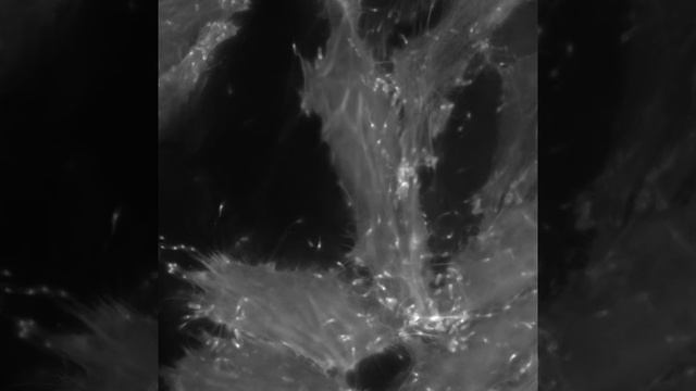 Listeria Monocytogenes Intracellular Motility
