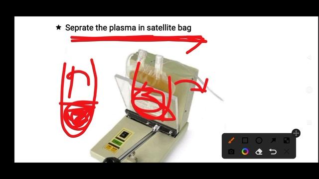 #02 Blood Banking! Blood Components, FFP ( fresh frozen plasma) preparation and indications. смотреть онлайн