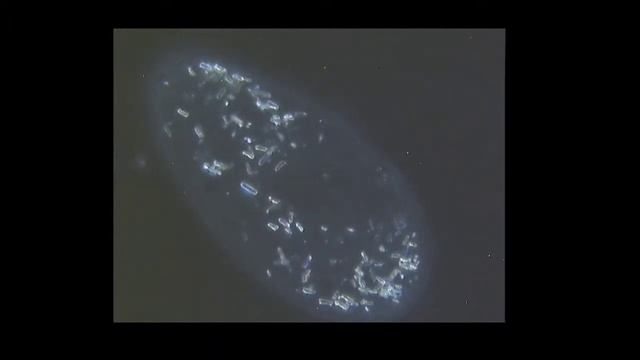 Paramecium in polarized darkfield. смотреть онлайн