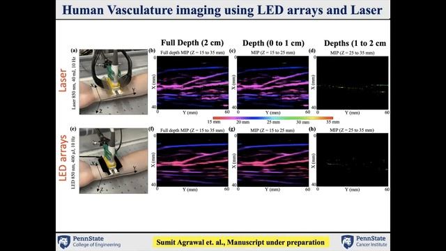 Acoustic X Webinar#7 Photoacoustic Imaging Capabilities of Light-Emitting-Diode (LED) Arrays смотреть онлайн