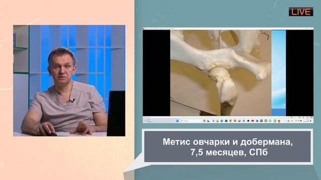 Лечение отита и сирингомиелии дисплазии тазобедренных суставов смотреть онлайн