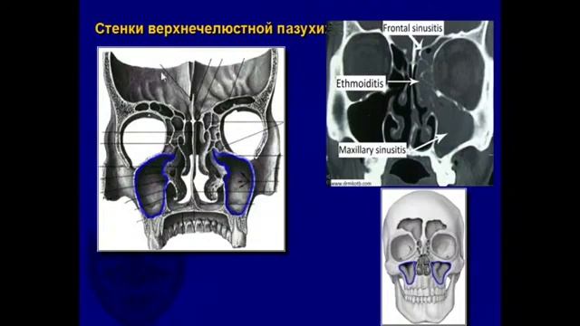 13:50 РИНИТЫ CИНУСИТЫ ИХ ОСЛОЖНЕНИЯ смотреть онлайн
