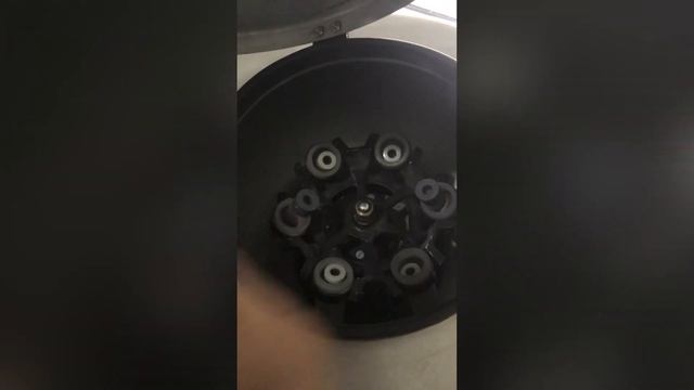 Scalp hair restoration using platelet rich plasma / growth factor concentration - dr.kavya /India / смотреть онлайн