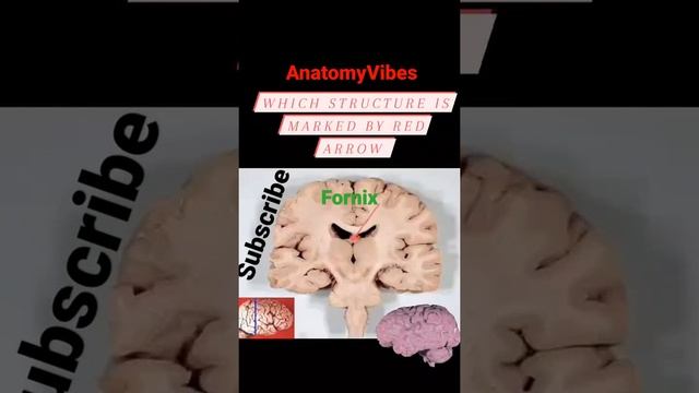Coronal Sections Of Brain | Fornix | Anatomy | Brain #anatomy #brain #neuroscience #neuro