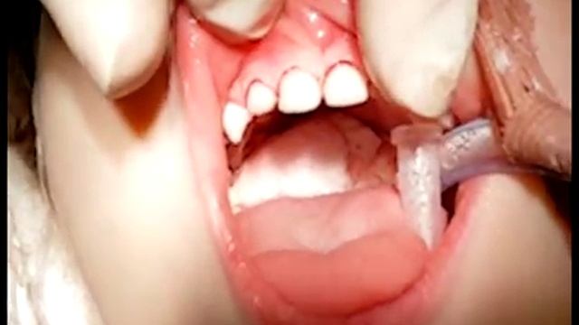 Сонечка из Североморска вылечила зубки в Москве смотреть онлайн