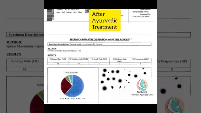 SPERM DNA FRAGMENTATION CORRECTED BY AYURVEDA AND PANCHKARMA смотреть онлайн