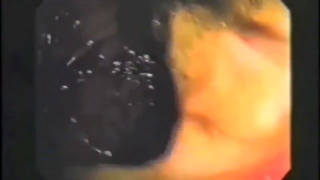 Исследования кишечника.  Хироми Шинья - известный японский врач .