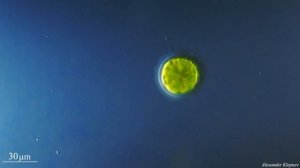 Algae Pandorina under microscope