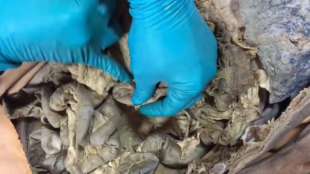 Digestive System 14 смотреть онлайн