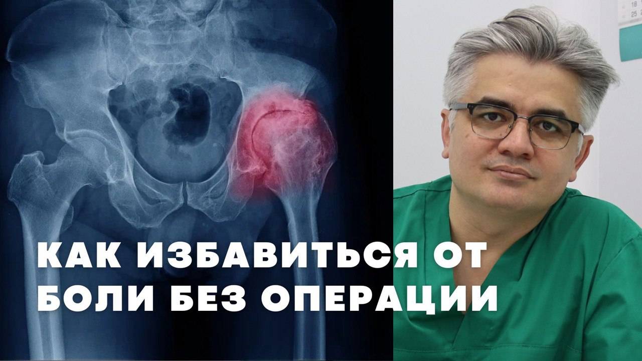 Можно ли обойтись без замены сустава? РЧД при коксартрозе и гонартрозе смотреть онлайн