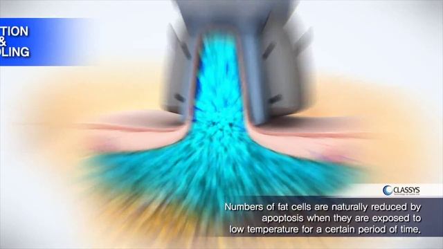 CLASSYS CLATUU 3D Simulation EN