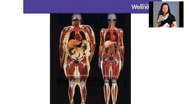 Как мы заботимся о здоровье? WELLNESS