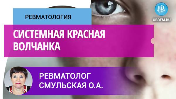 Ревматолог Смульская О.А.: Системная красная волчанка смотреть онлайн